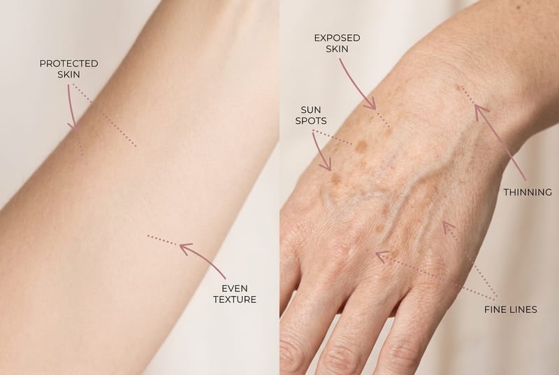 How Your Skin Ages and What You Can Influence